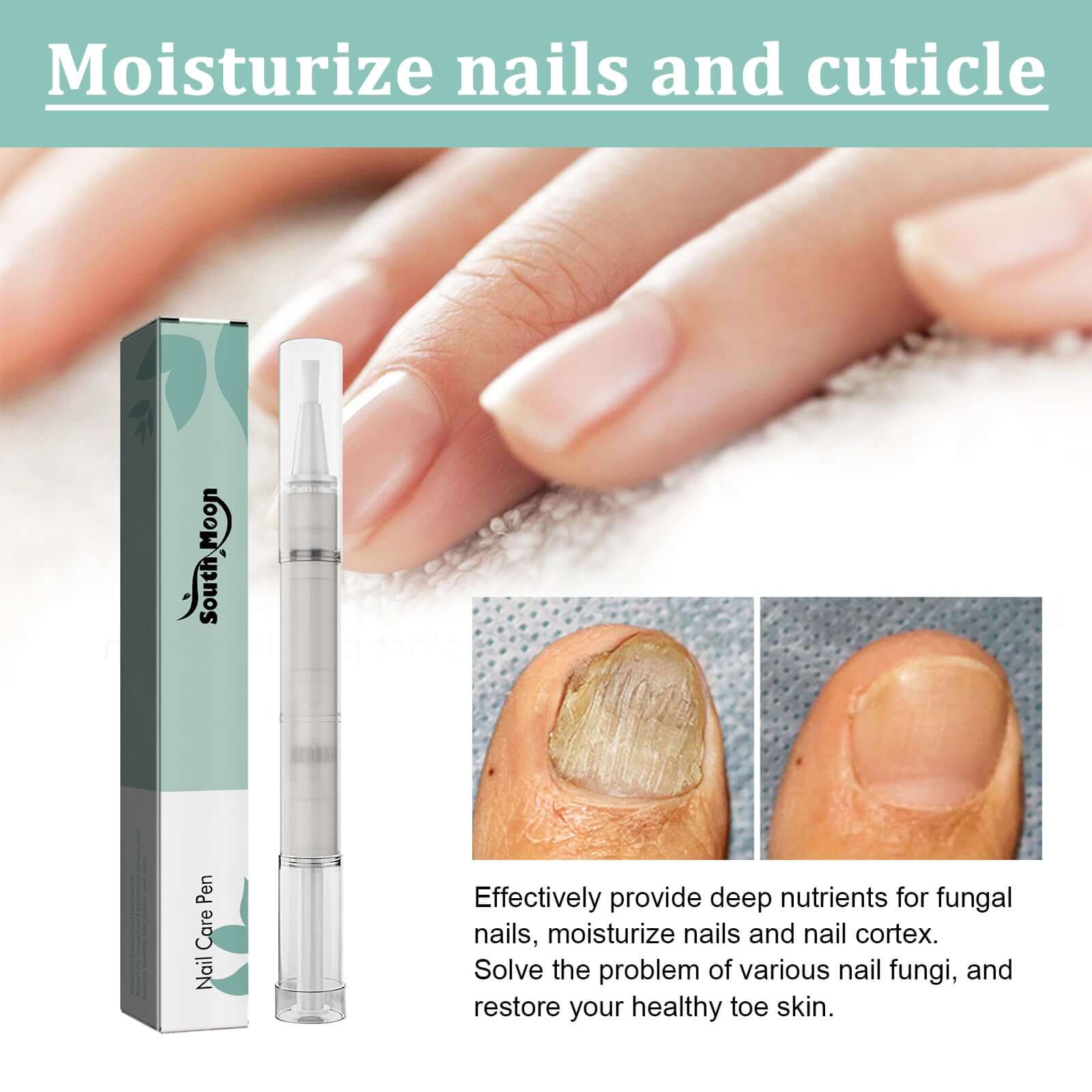 South Moon Nail Care Pen, Grey Nail Care Clean Brightening Nail Thickening Grey Nail Repair Pen
