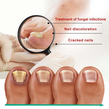 OUHOE Nail Care Soft Nail Care Daily Clean Gentle Maintenance Moisturizing Nail Care Solution
