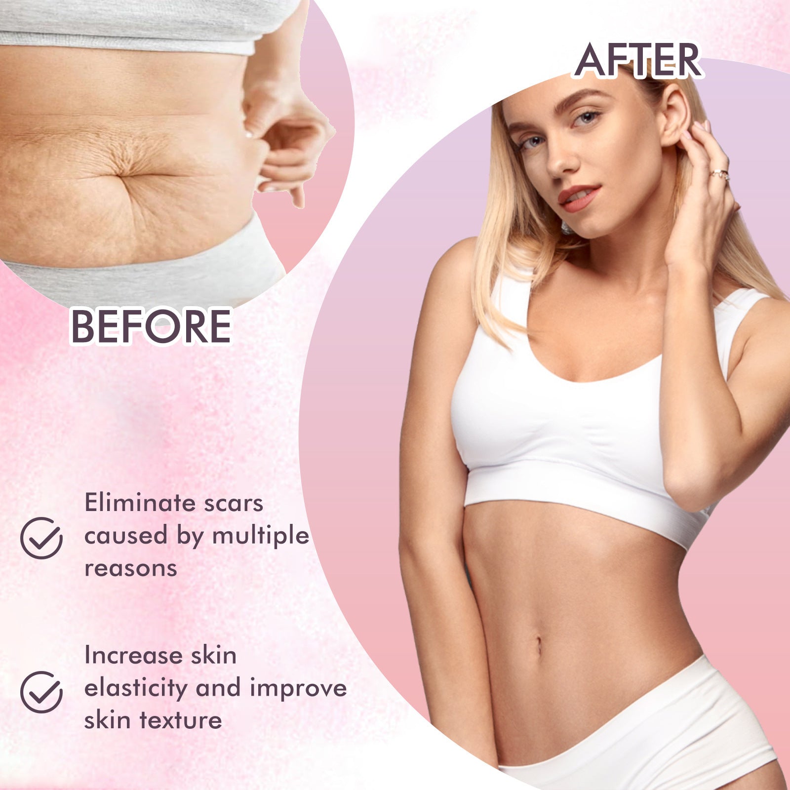 Skincare Body Oil, Fade Scars And Fine Lines Of Pregnancy Moisturize And Repair Delicate And Smooth Body Skin