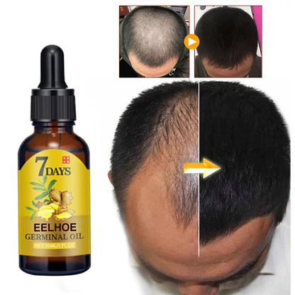 EELHOE Ginger Hair Care Solution For Hair Nourishing And Moisturizing Hair Care For Hair Stabilizing And Preventing Hair Loss