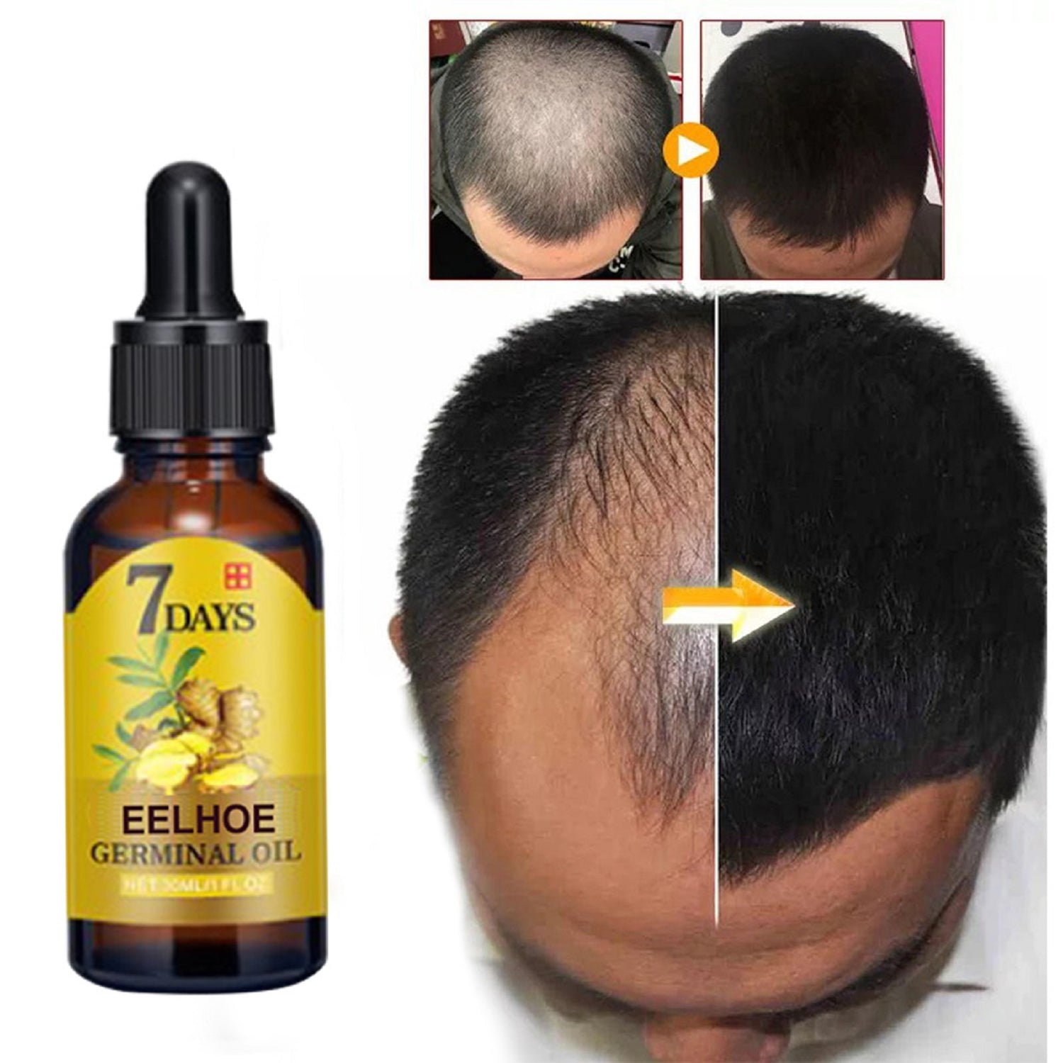 Ginger Hair Care Solution For Hair Nourishing And Moisturizing Hair Care For Hair Stabilizing And Preventing Hair Loss