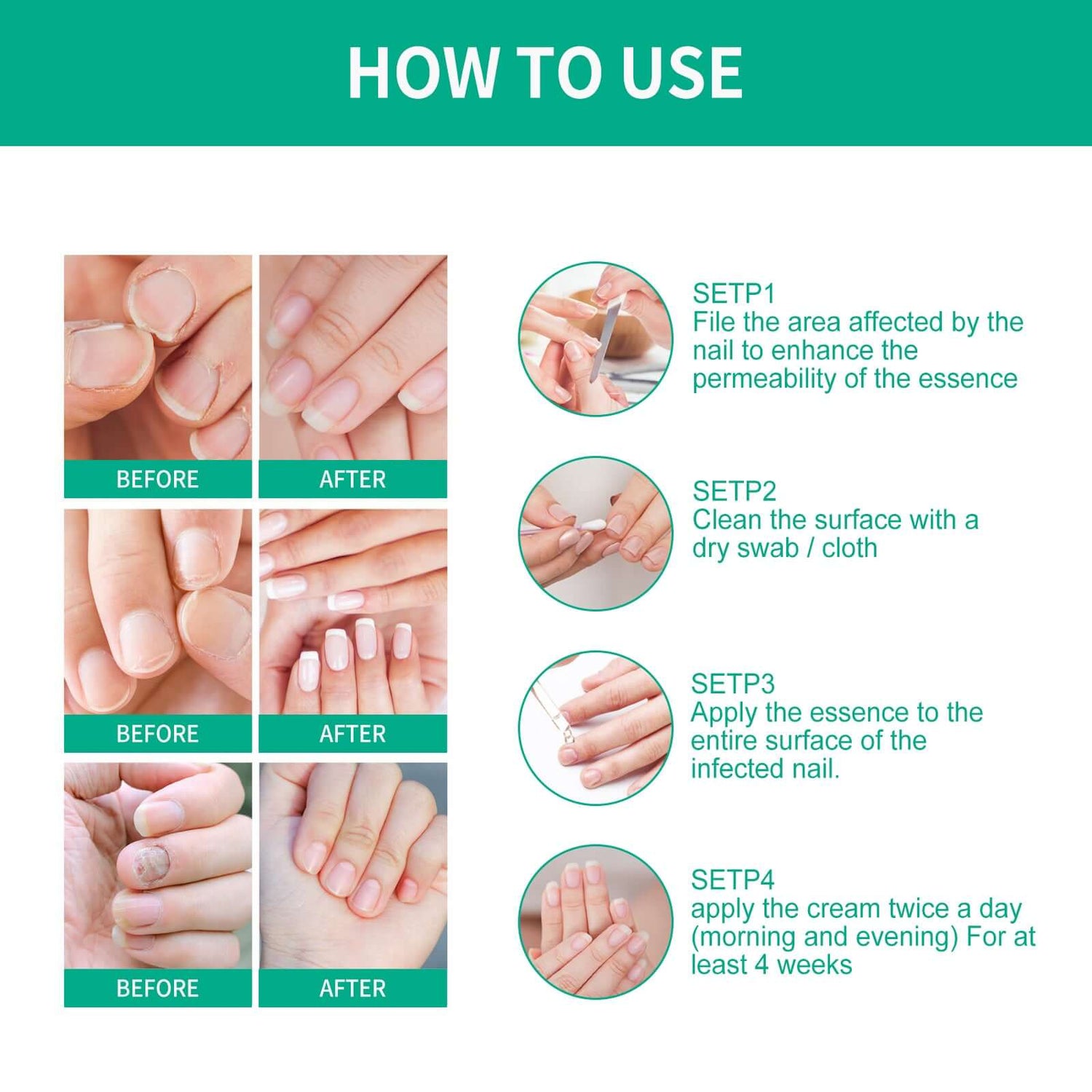 OUHOE Nail Care Soft Nail Care Daily Clean Gentle Maintenance Moisturizing Nail Care Solution