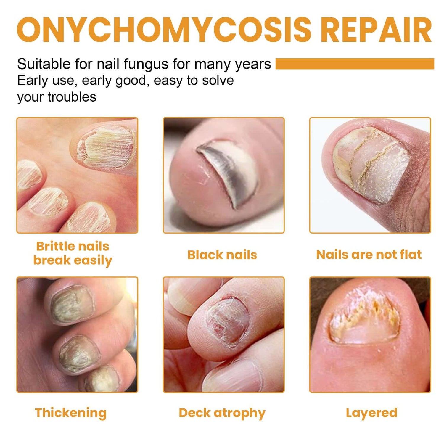 Image showcasing various types of nail damage with text ononychomycosis repair, highlighting fungal nail repair patches.