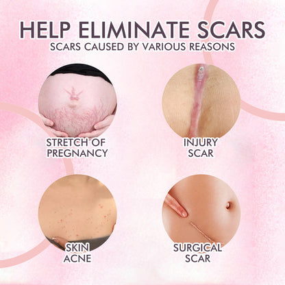 Skincare Body Oil, Fade Scars And Fine Lines Of Pregnancy Moisturize And Repair Delicate And Smooth Body Skin
